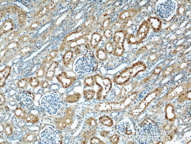 GSTA1 Antibody in Immunohistochemistry (Paraffin) (IHC (P))