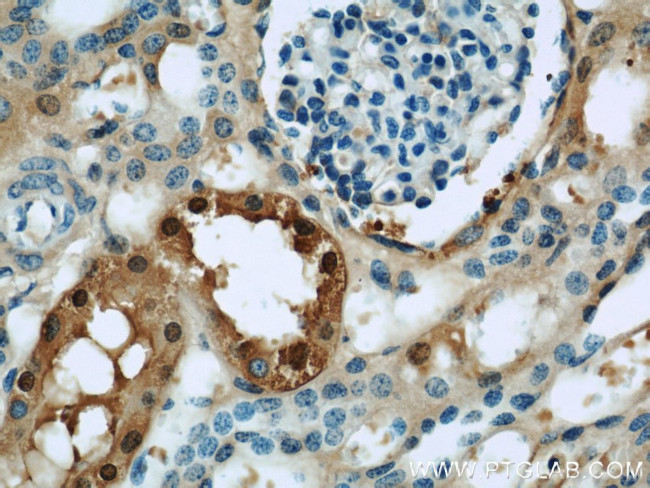 GSTA1 Antibody in Immunohistochemistry (Paraffin) (IHC (P))