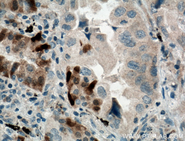 GSTA1 Antibody in Immunohistochemistry (Paraffin) (IHC (P))