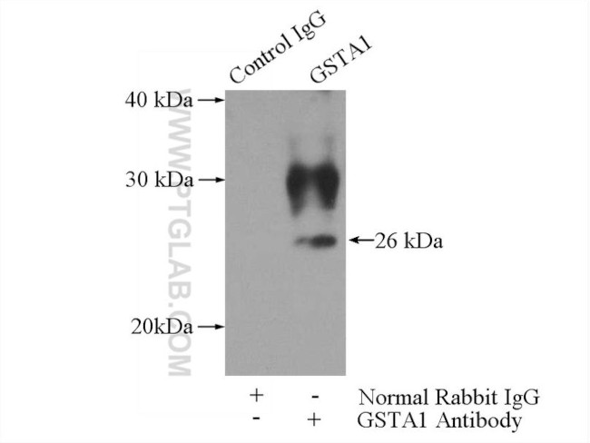 GSTA1 Antibody in Immunoprecipitation (IP)