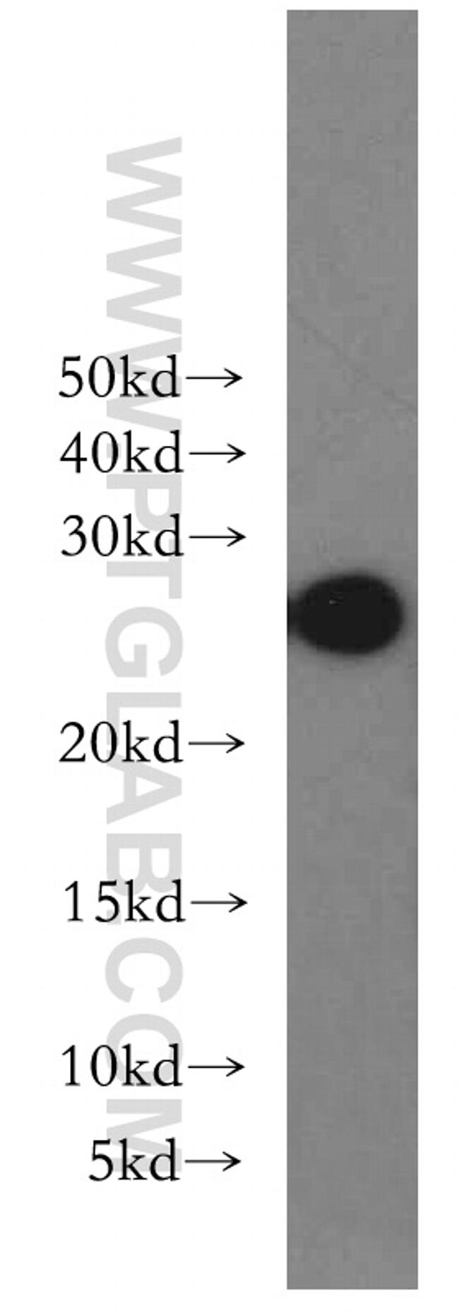 GSTA1 Antibody in Western Blot (WB)