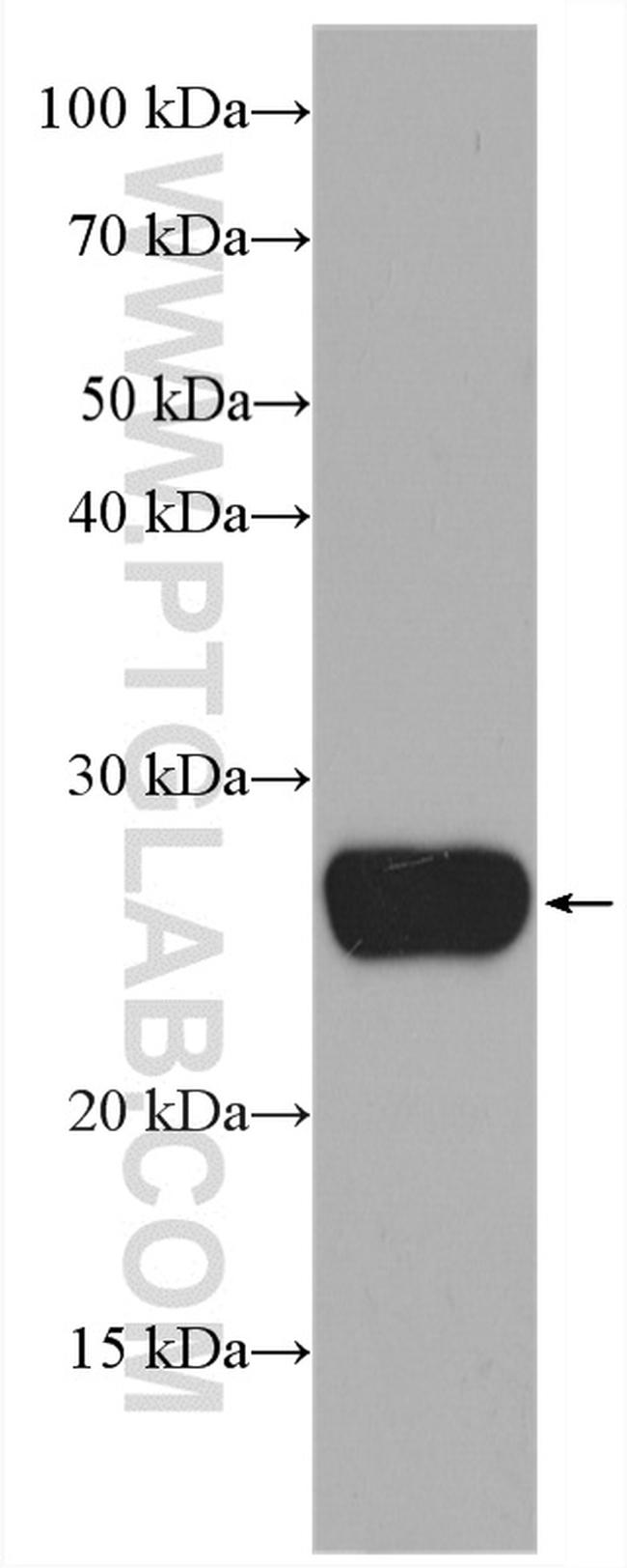 GSTA1 Antibody in Western Blot (WB)