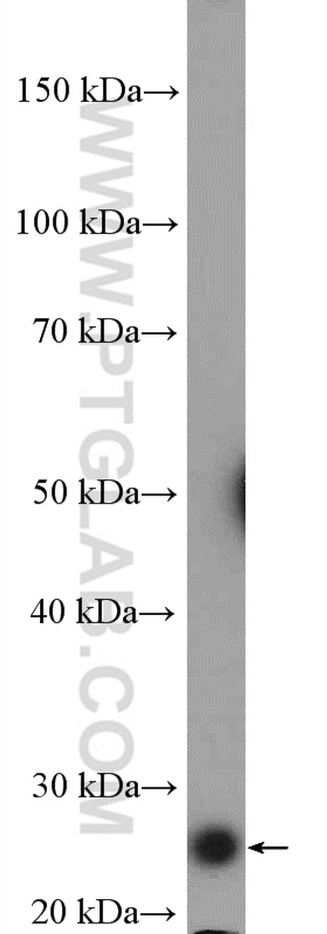 GSTA1 Antibody in Western Blot (WB)