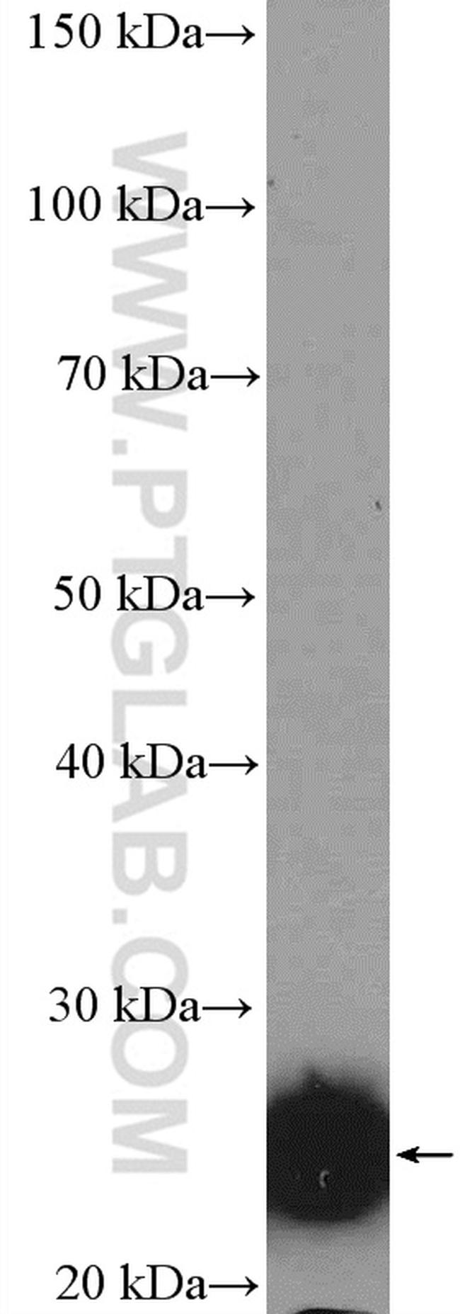 GSTA1 Antibody in Western Blot (WB)