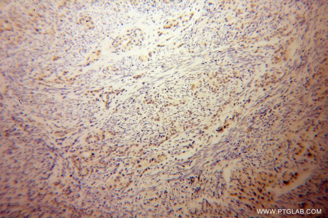 LCOR Antibody in Immunohistochemistry (Paraffin) (IHC (P))