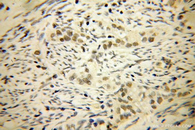 LCOR Antibody in Immunohistochemistry (Paraffin) (IHC (P))