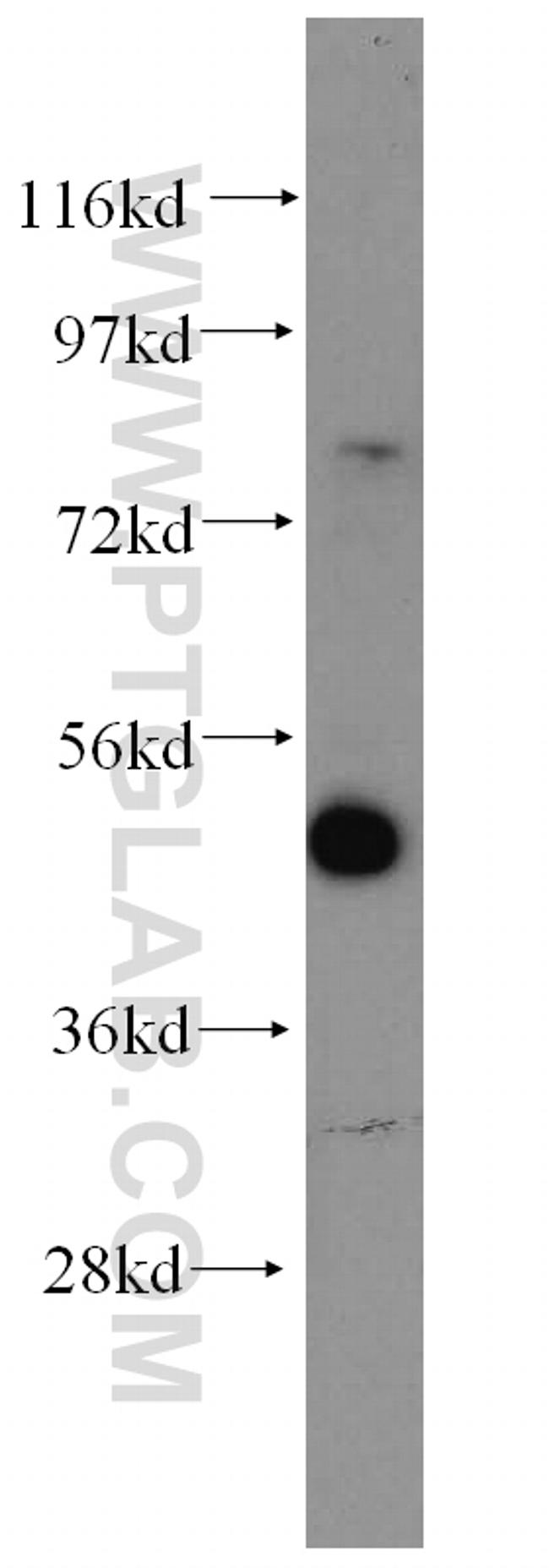 LCOR Antibody in Western Blot (WB)