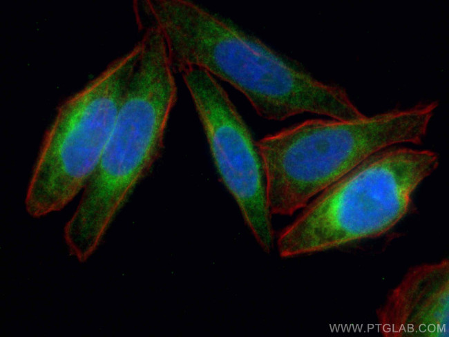 VAPB Antibody in Immunocytochemistry (ICC/IF)