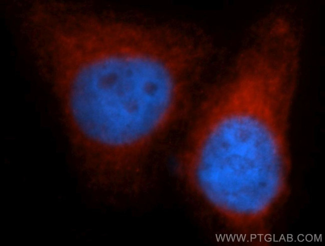 VAPB Antibody in Immunocytochemistry (ICC/IF)