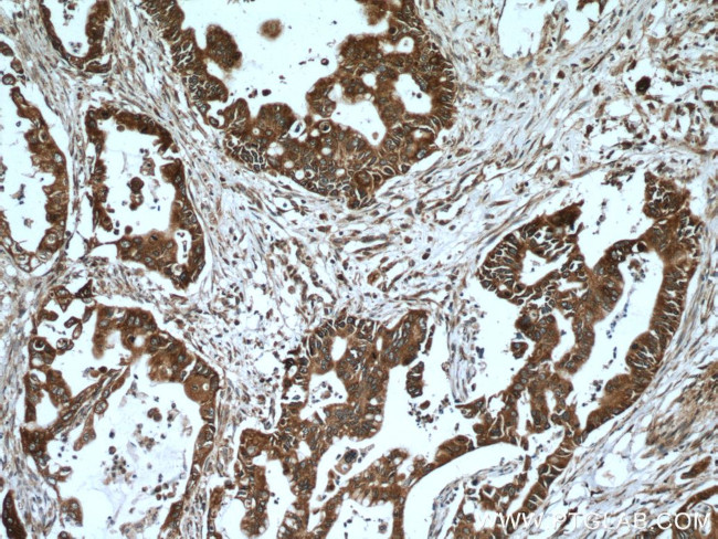 VAPB Antibody in Immunohistochemistry (Paraffin) (IHC (P))