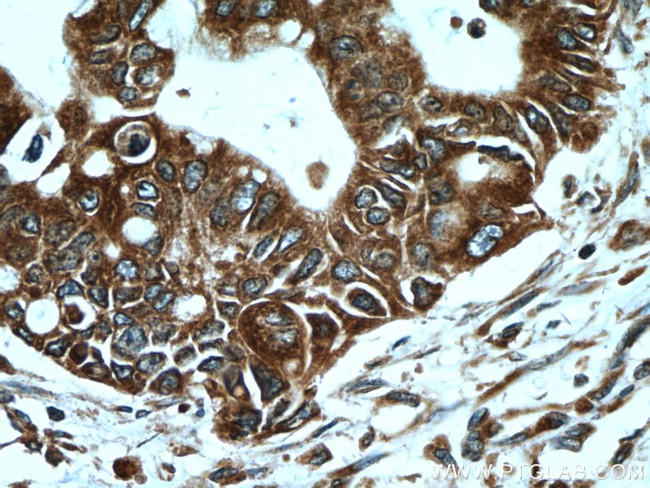 VAPB Antibody in Immunohistochemistry (Paraffin) (IHC (P))