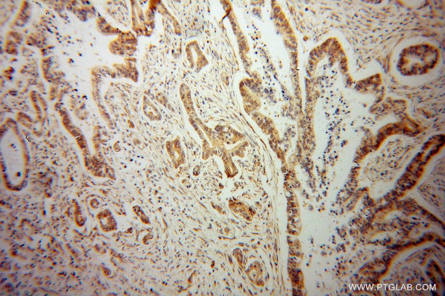 VAPB Antibody in Immunohistochemistry (Paraffin) (IHC (P))