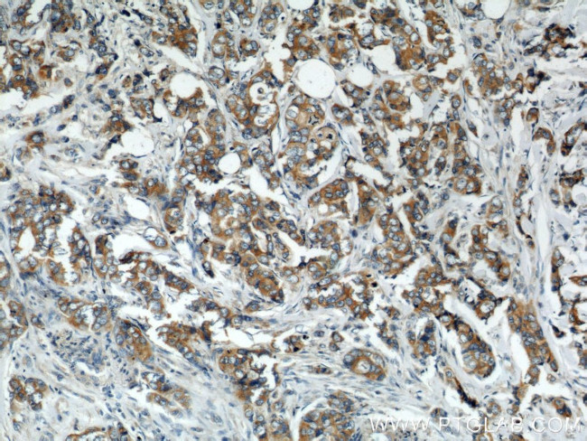 VAPB Antibody in Immunohistochemistry (Paraffin) (IHC (P))