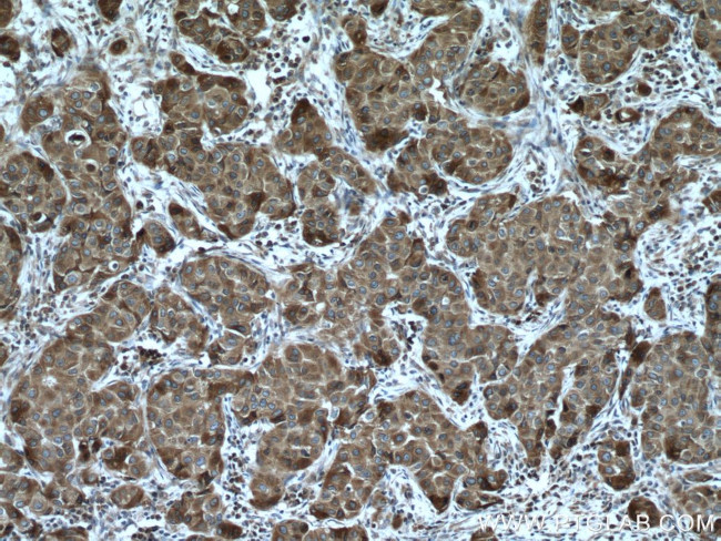 VAPB Antibody in Immunohistochemistry (Paraffin) (IHC (P))