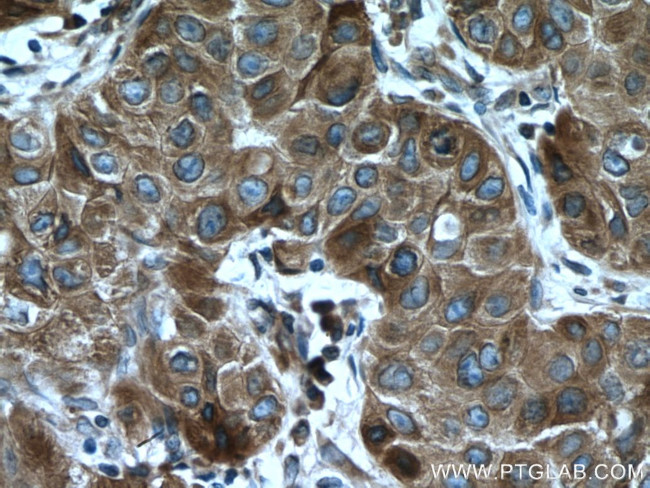 VAPB Antibody in Immunohistochemistry (Paraffin) (IHC (P))