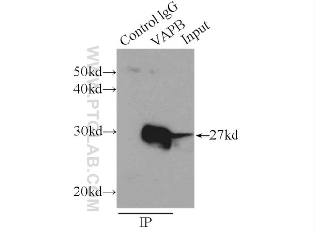 VAPB Antibody in Immunoprecipitation (IP)