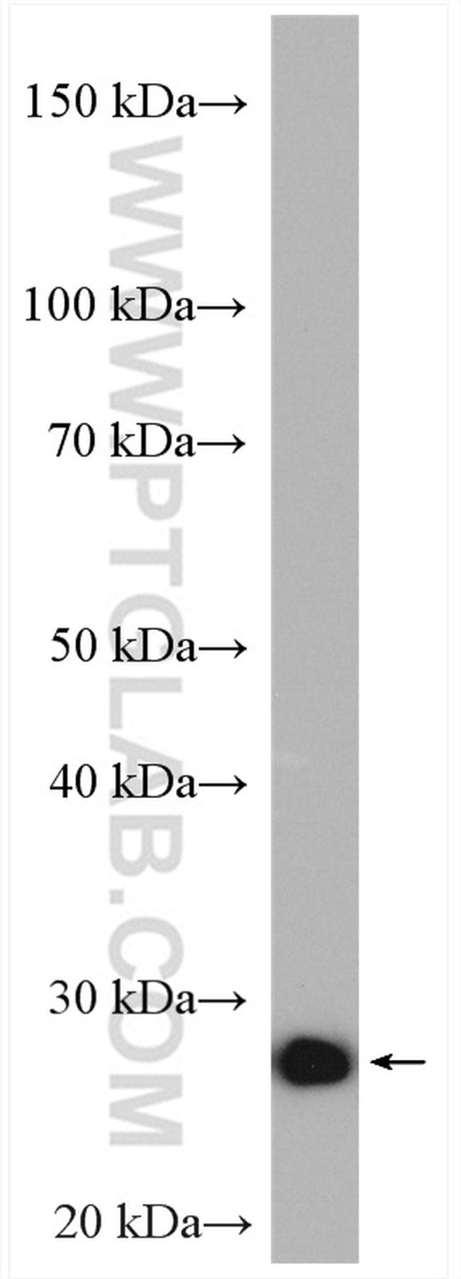 VAPB Antibody in Western Blot (WB)