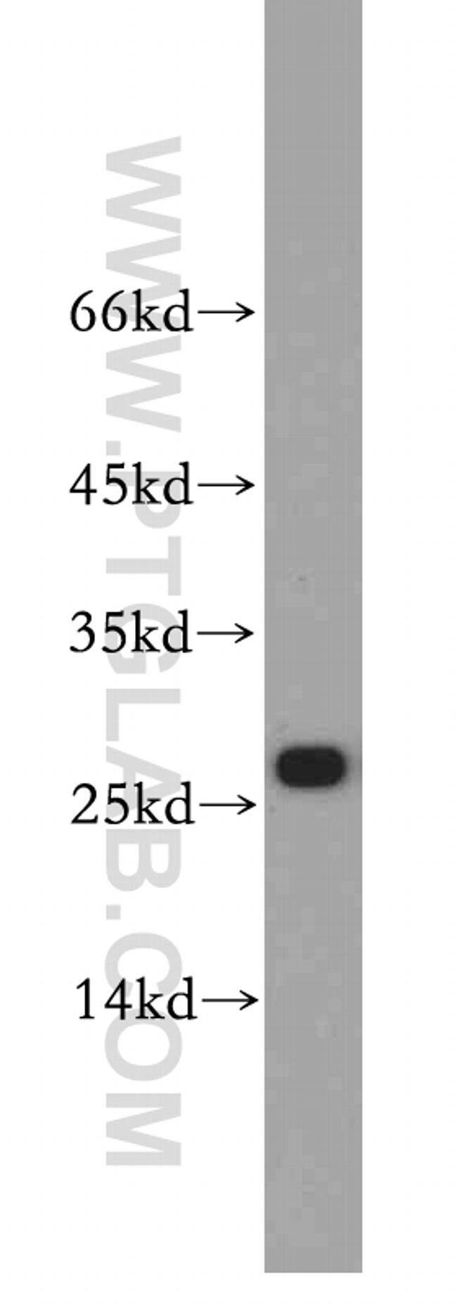 VAPB Antibody in Western Blot (WB)