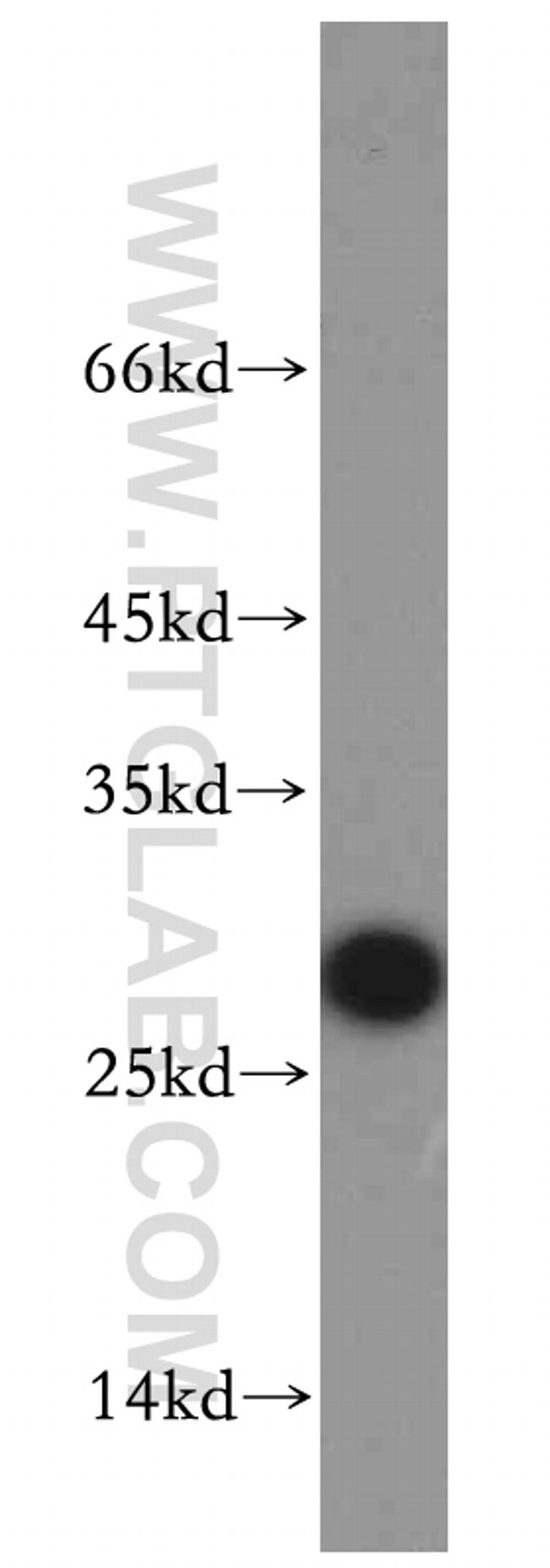 VAPB Antibody in Western Blot (WB)