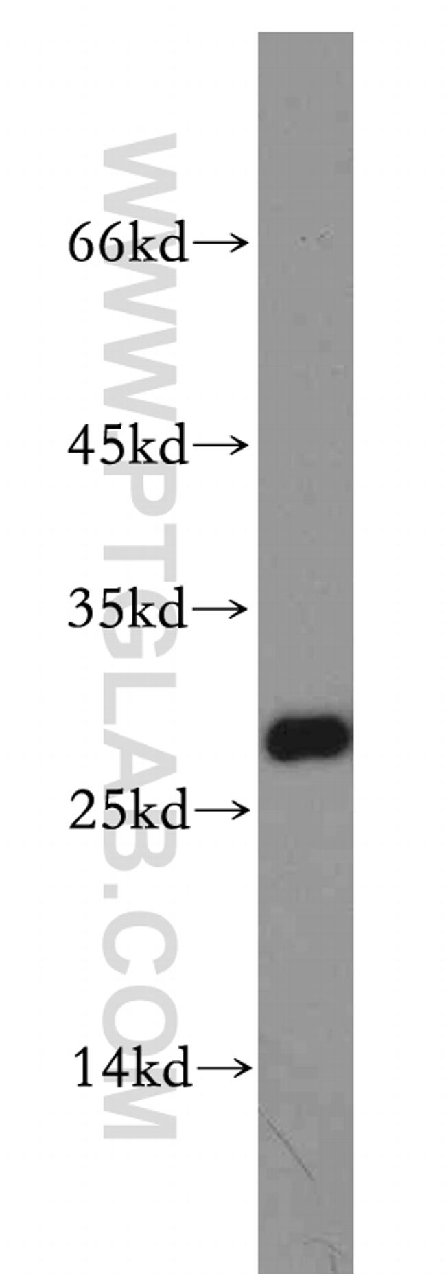 VAPB Antibody in Western Blot (WB)