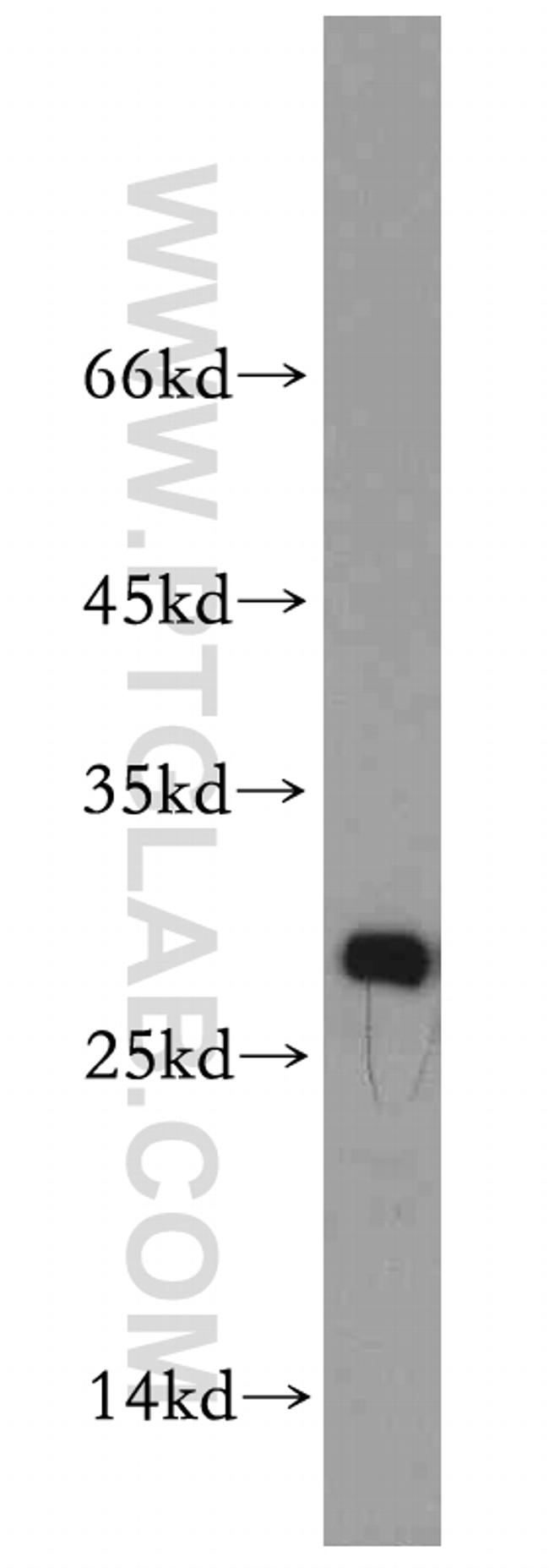 VAPB Antibody in Western Blot (WB)