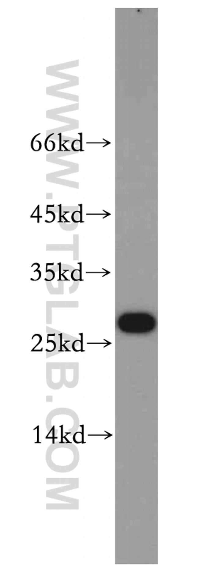 VAPB Antibody in Western Blot (WB)