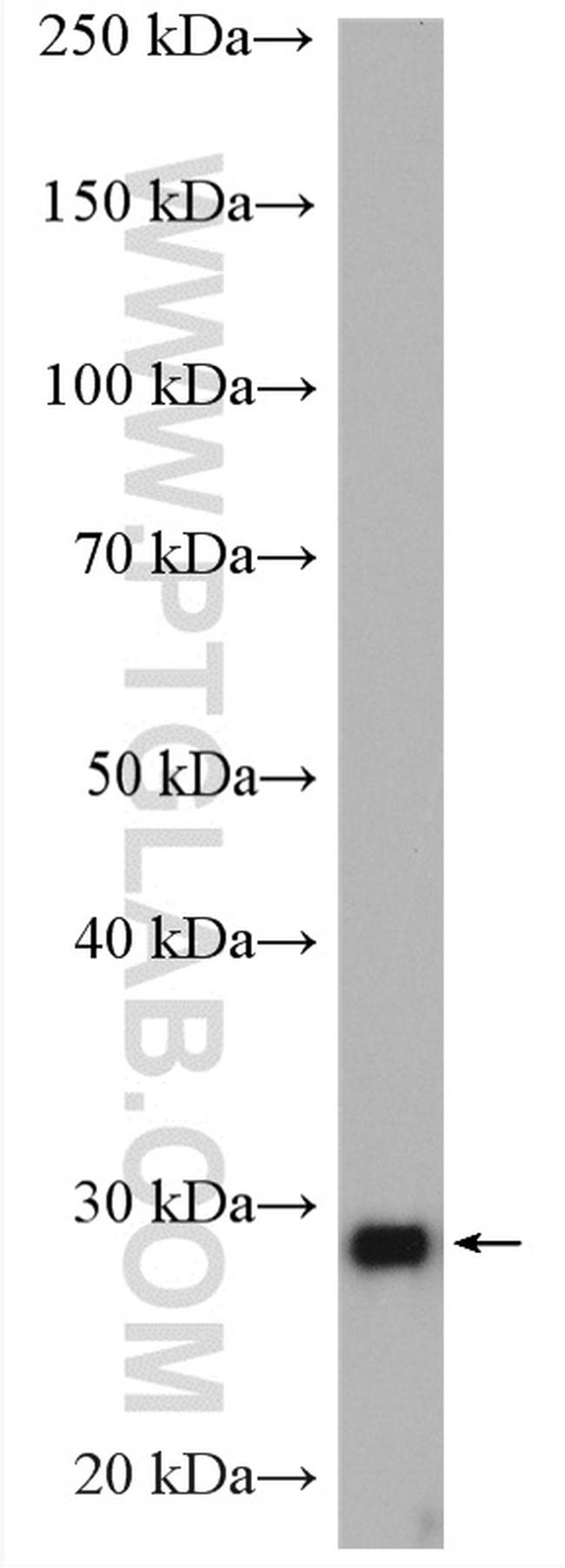 VAPB Antibody in Western Blot (WB)