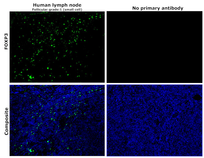 FOXP3 Antibody in Immunohistochemistry (Paraffin) (IHC (P))