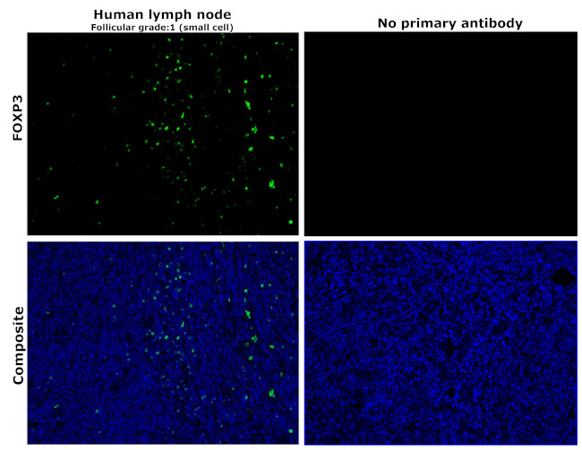 FOXP3 Antibody in Immunohistochemistry (Paraffin) (IHC (P))