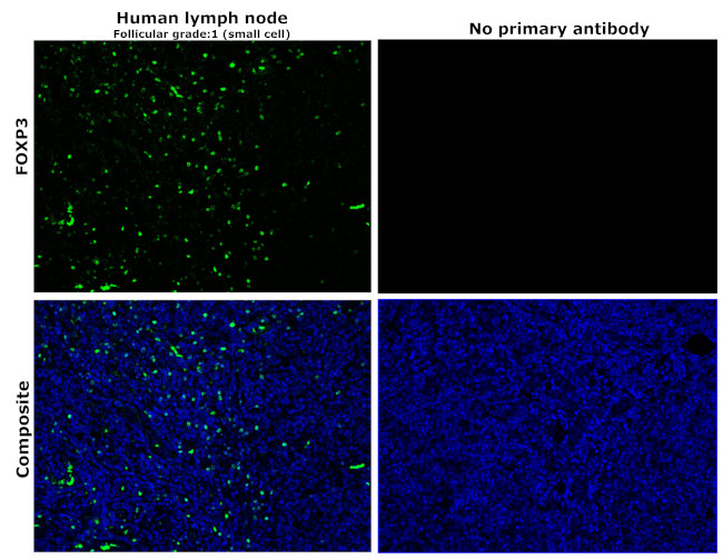 FOXP3 Antibody in Immunohistochemistry (Paraffin) (IHC (P))