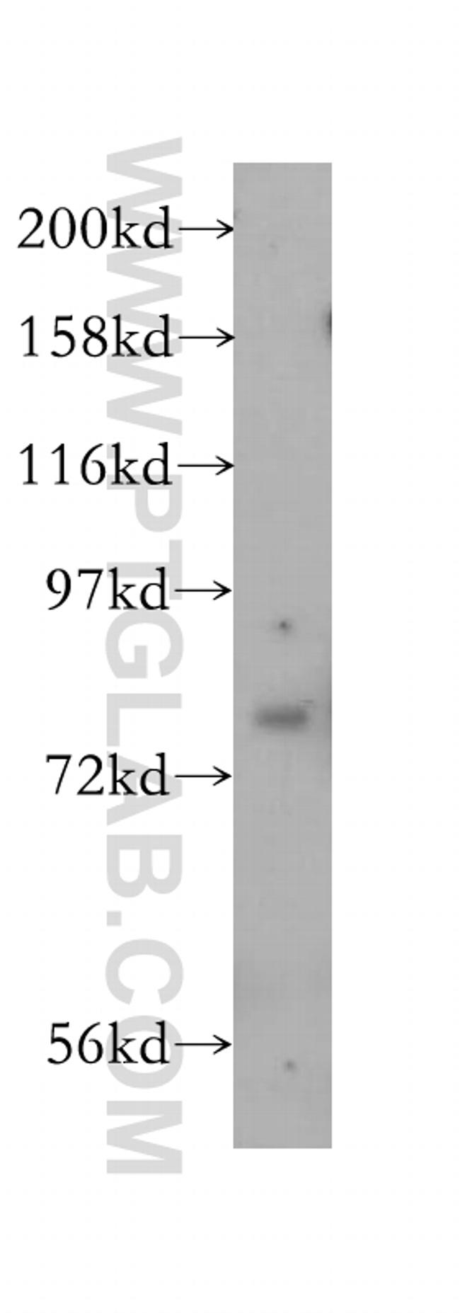 SIRP alpha Antibody in Western Blot (WB)