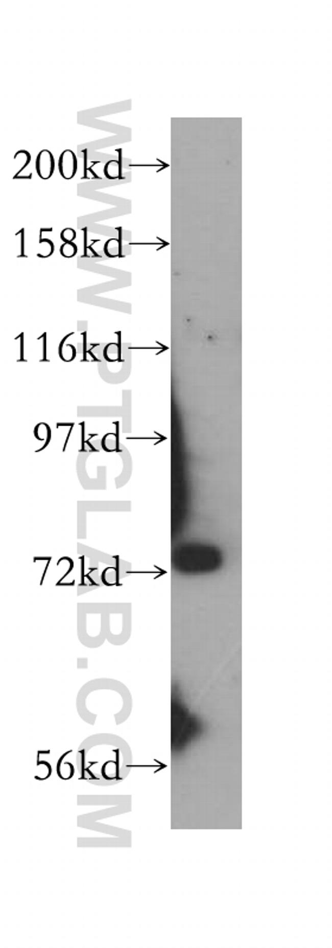 SIRP alpha Antibody in Western Blot (WB)