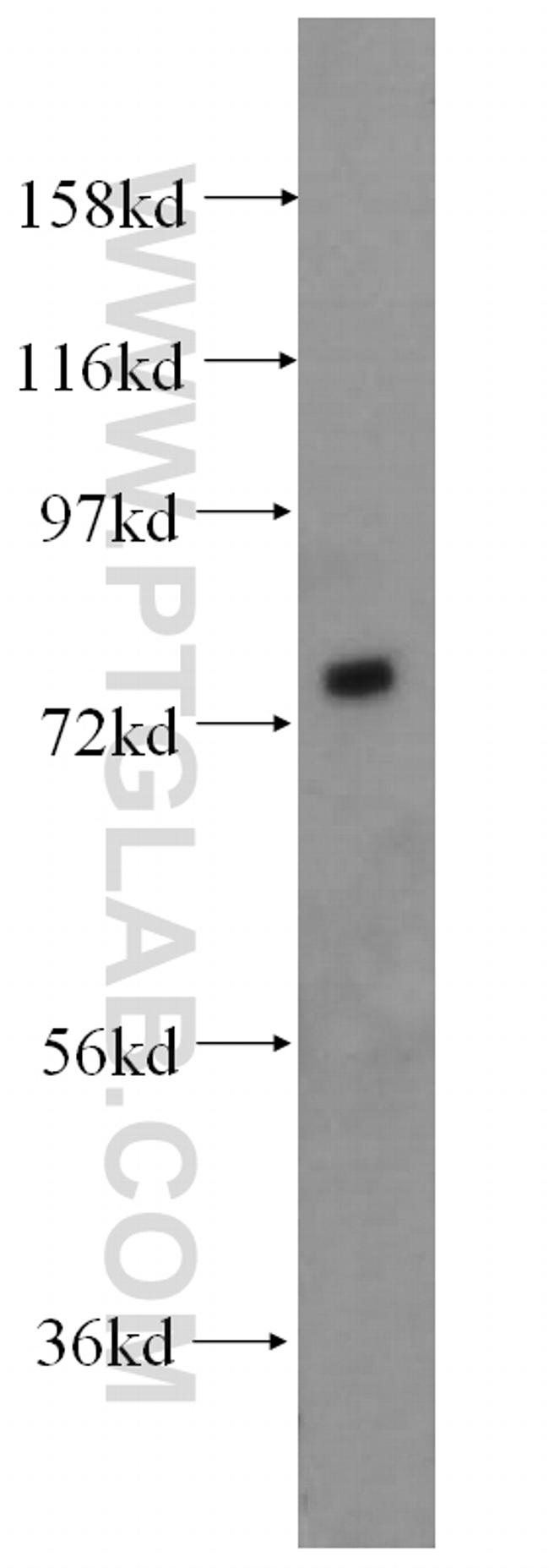 SIRP alpha Antibody in Western Blot (WB)