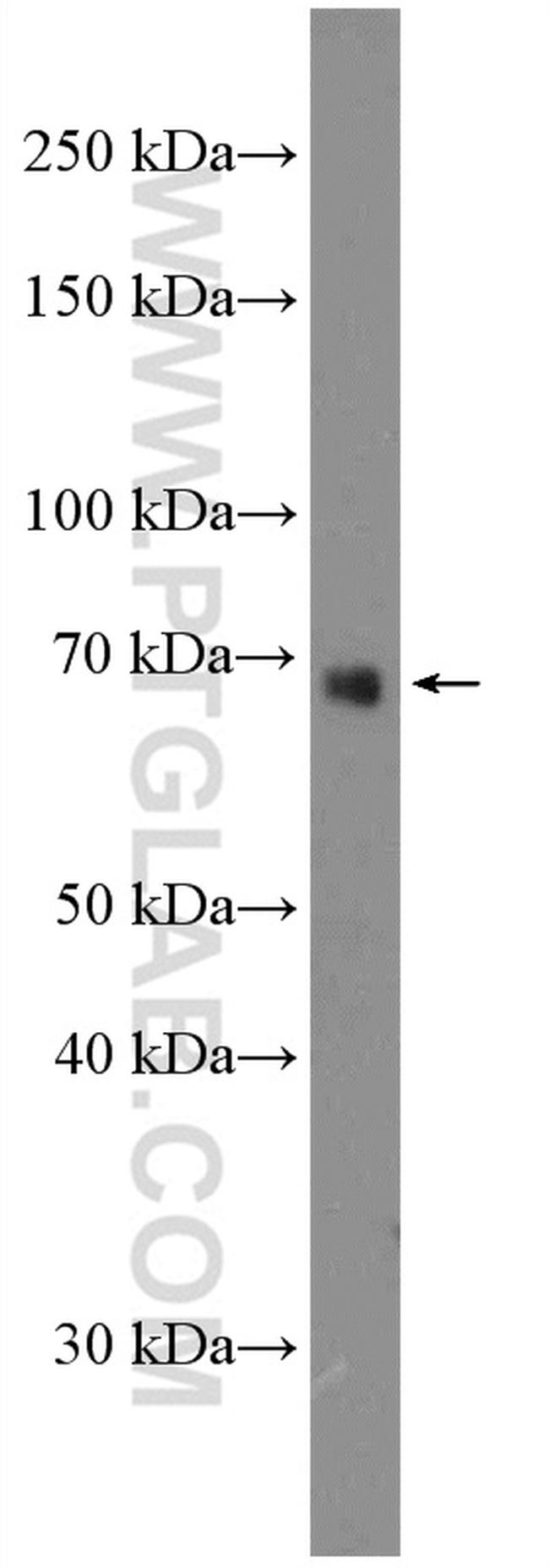 SIRP alpha Antibody in Western Blot (WB)