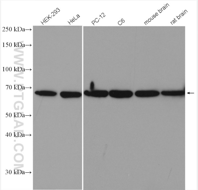 p70(S6K) Antibody in Western Blot (WB)