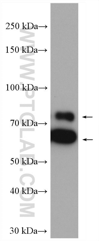 p70(S6K) Antibody in Western Blot (WB)