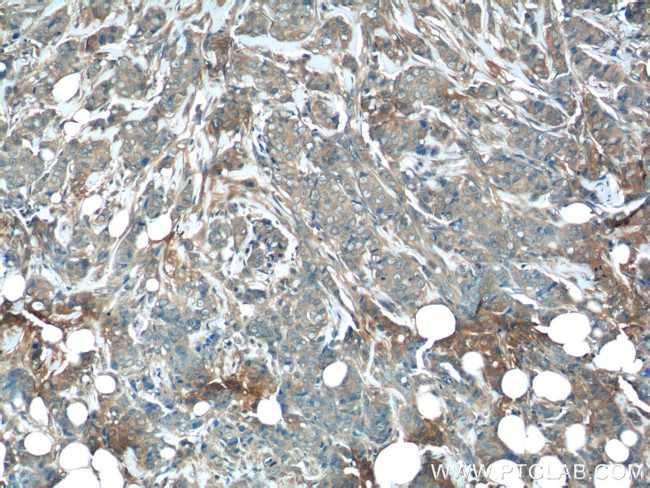 p70(S6K) Antibody in Immunohistochemistry (Paraffin) (IHC (P))