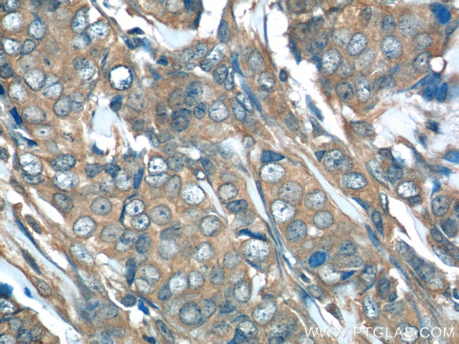 p70(S6K) Antibody in Immunohistochemistry (Paraffin) (IHC (P))