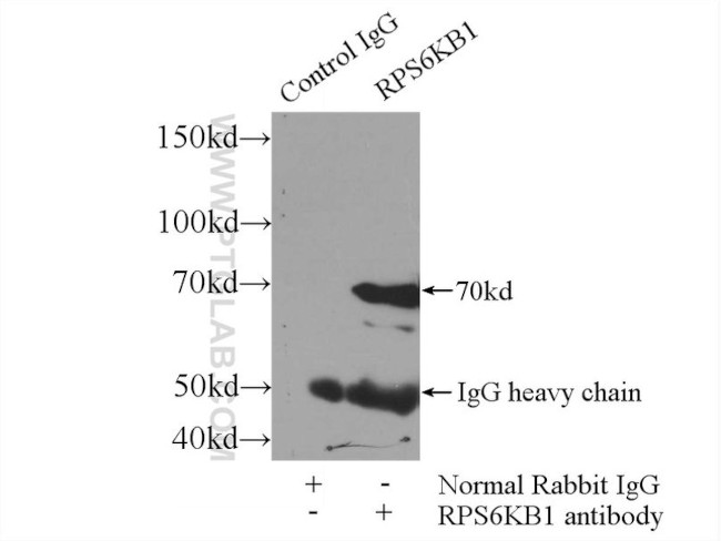 p70(S6K) Antibody in Immunoprecipitation (IP)