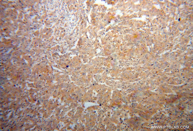 p70(S6K) Antibody in Immunohistochemistry (Paraffin) (IHC (P))