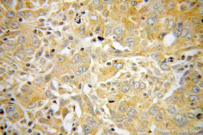 p70(S6K) Antibody in Immunohistochemistry (Paraffin) (IHC (P))