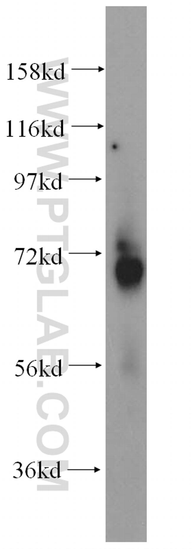 p70(S6K) Antibody in Western Blot (WB)