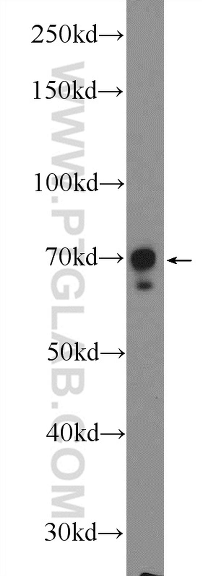 p70(S6K) Antibody in Western Blot (WB)