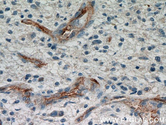 CD34 Antibody in Immunohistochemistry (Paraffin) (IHC (P))