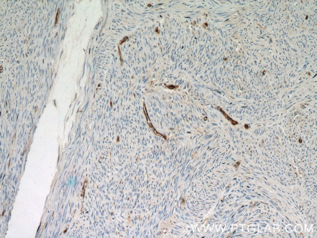 CD34 Antibody in Immunohistochemistry (Paraffin) (IHC (P))