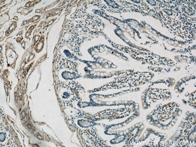 CD34 Antibody in Immunohistochemistry (Paraffin) (IHC (P))