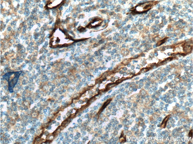 CD34 Antibody in Immunohistochemistry (Paraffin) (IHC (P))