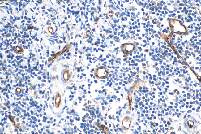 CD34 Antibody in Immunohistochemistry (Paraffin) (IHC (P))