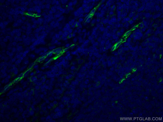 CD34 Antibody in Immunohistochemistry (PFA fixed) (IHC (PFA))