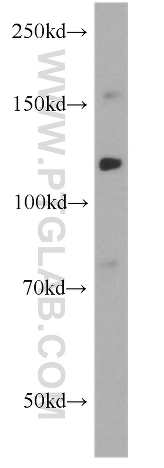 CD34 Antibody in Western Blot (WB)